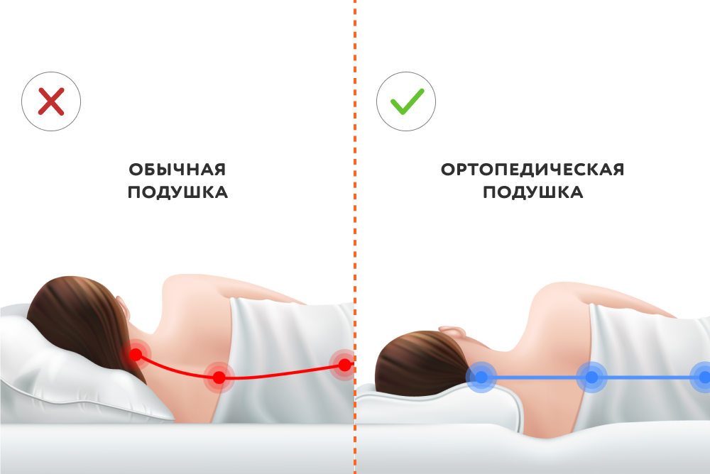 Ортопедическая подушка для новорожденных: за и против